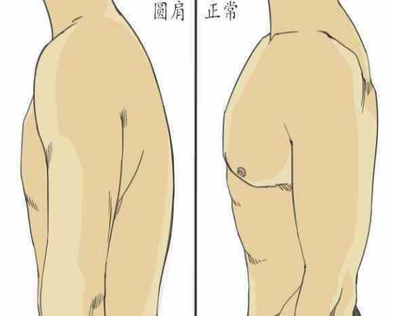 1635237295155037.png 上交叉综合征176.png